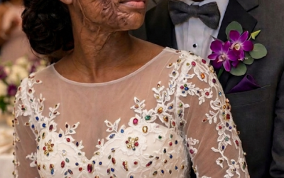 I Married a Blind Man So He’d Never See My Scars – On Our Wedding Night, He Said, ‘You Need to Know the Truth I’ve Been Hiding for 20 Years’