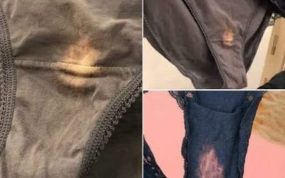 If you find a “bleach” patch on your underwear, here’s what it means
