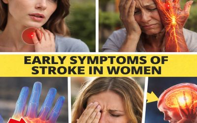 10 Important Stroke Symptoms in Women You Should Never Ignore for Early Recognition and Better Results