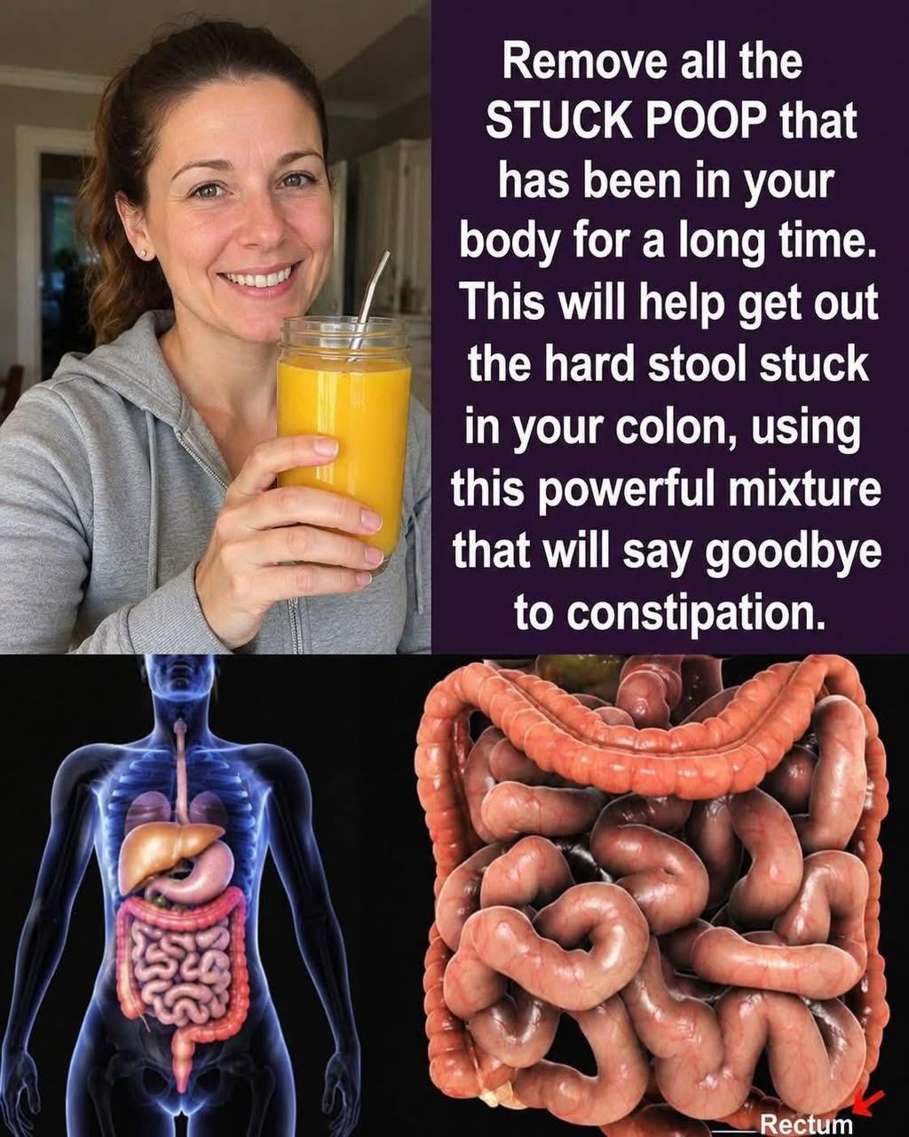 Get rid of all the stuck poop you've had in your body for a long time. This will even get rid of the gum you ate in kindergarten. With this powerful mixture, you'll say goodbye to constipation. I'll give you the recipe for a simple
