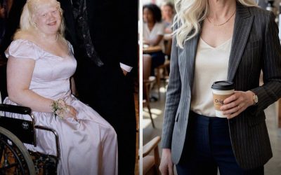 At Prom, Only One Boy Asked Me to Dance Because I Was in a Wheelchair – 30 Years Later, I Met Him Again and He Needed Help