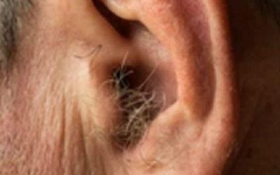 Did you know that if your ear hairs grow, it is because your body is… See more
