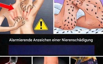 15 Serious Warning Signs of Kidney Disease You Need to Recognize Early